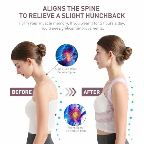 Posture corrector showing before and after effects on spine alignment.