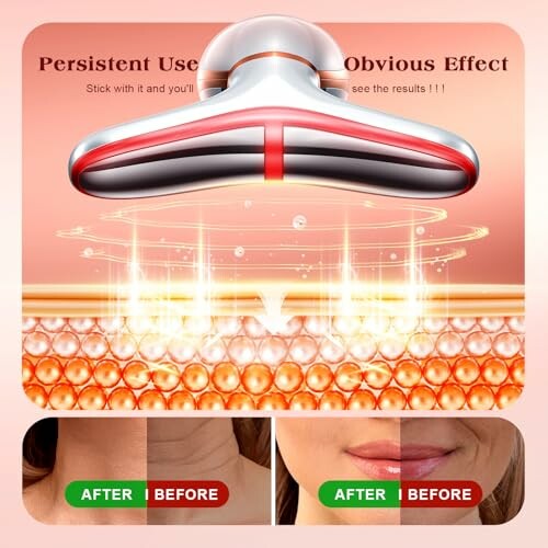 Illustration of a skincare device showing before and after effects on skin.